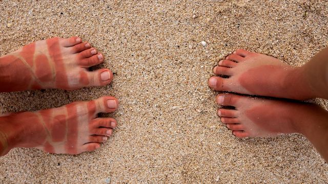 Prendre soin de ses pieds en été
